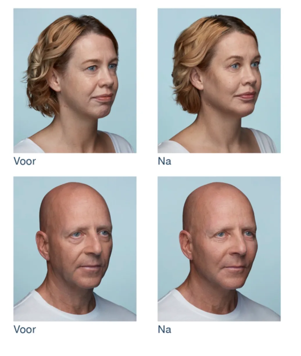 Wat kan je verwachten?