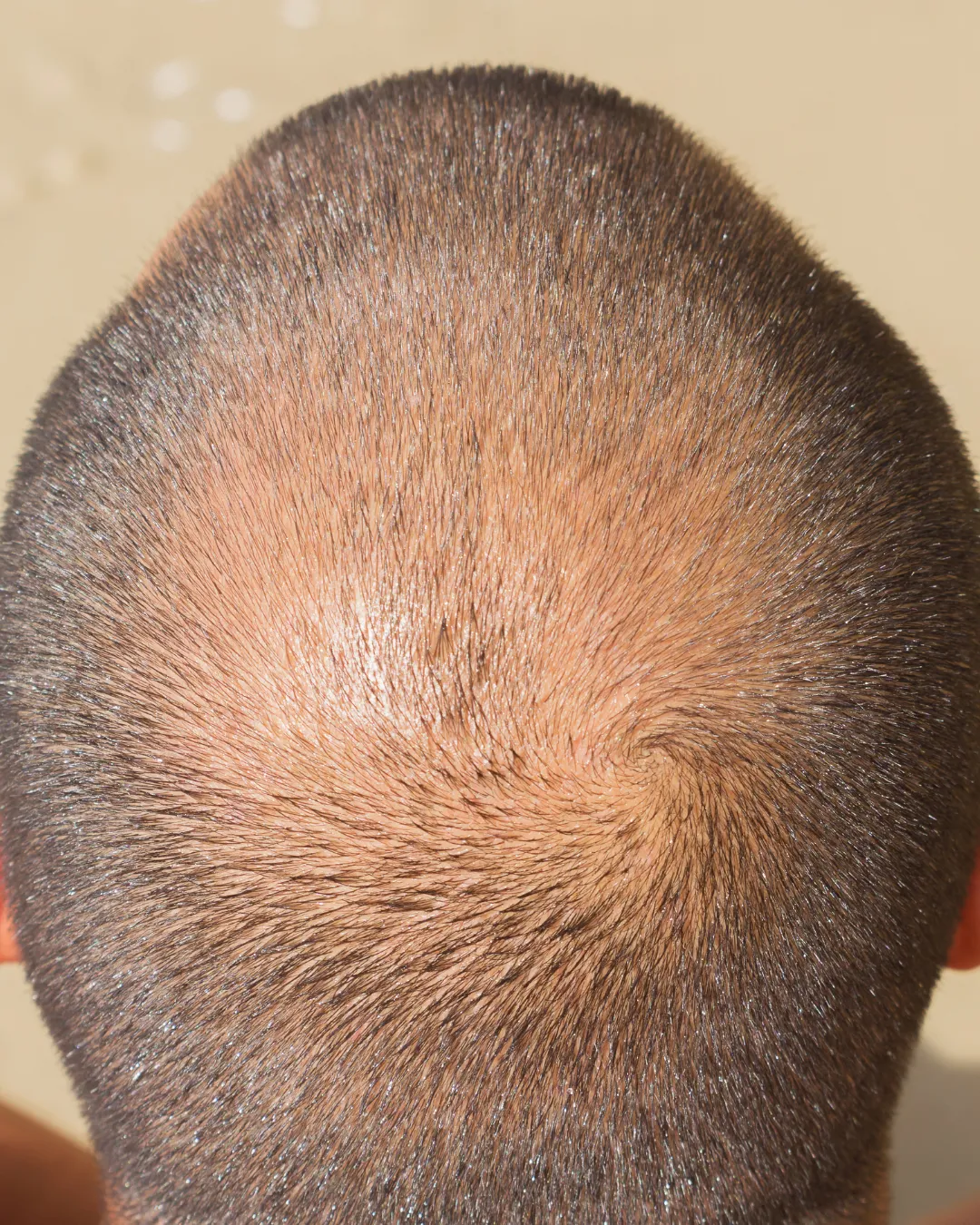 Hoe behoud ik het resultaat van Dr CYJ Hair Filler?