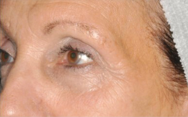 Antiaging nax Antiaging nax