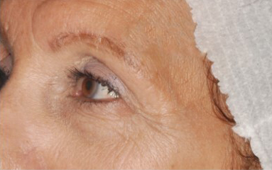 Antiaging voor Antiaging voor