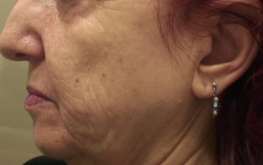 Antiaging voor1 Antiaging voor1