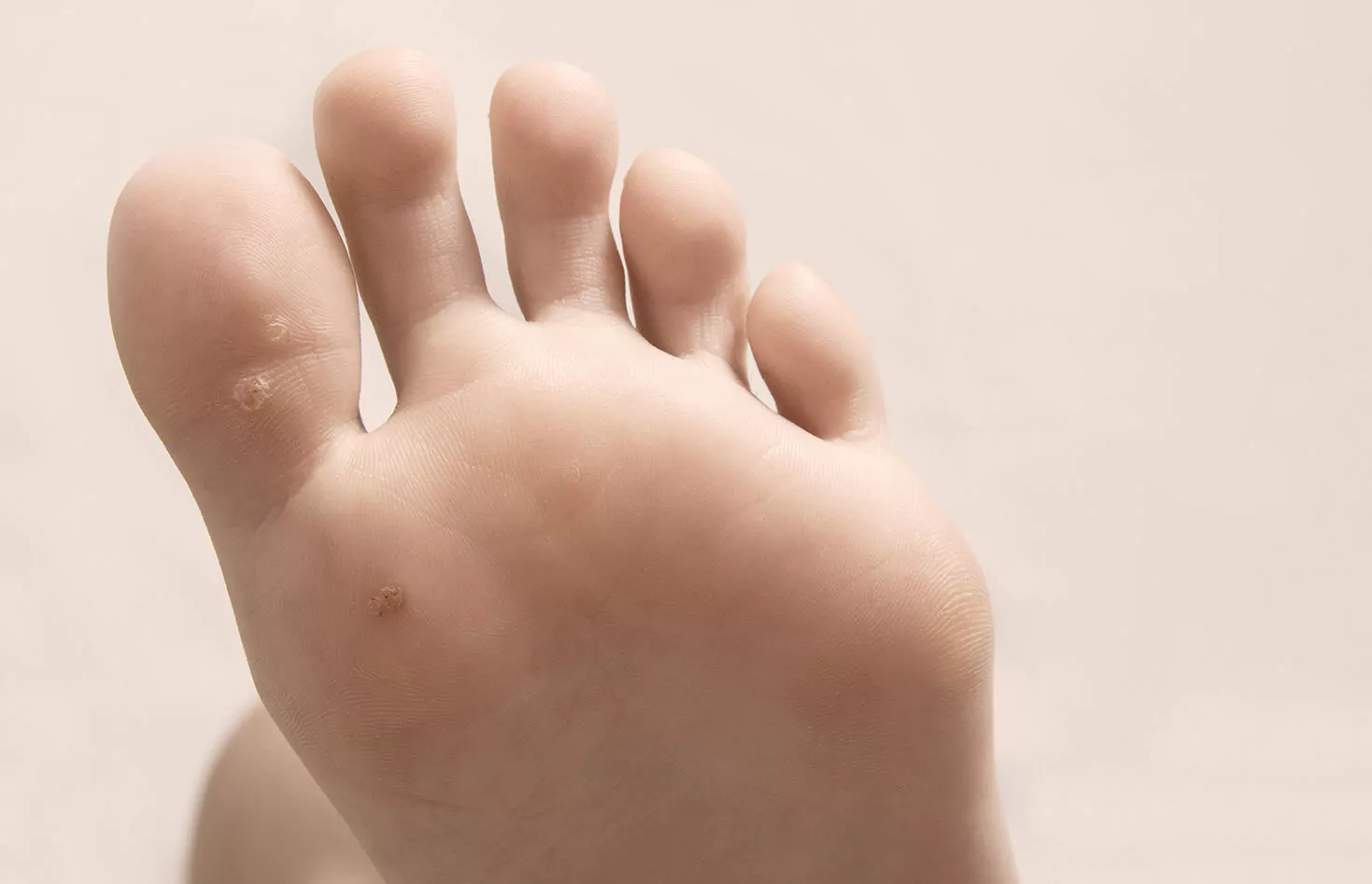 inspecting man's feet with a large problem callus